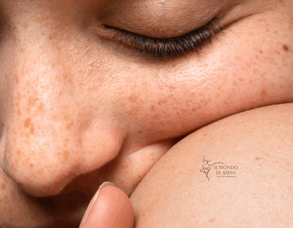 La Neurofibromatosi di tipo 1 è tra le malattie rare, una delle più frequenti. Si tratta di una malattia associata a una mutazione della neurofibromina, una proteina codificata dal gene oncosoppressore NF1, che predispone allo sviluppo di tumori con una probabilità maggiore del normale. Coinvolge diversi distretti corporei come la cute, gli occhi, il sistema nervoso centrale e le ossa.  La malattia colpisce nel mondo una persona su 3 mila e in Italia si stima coinvolga circa 20 mila pazienti, che raccontano una condizione molto eterogenea con casi lievi e casi molto gravi.  